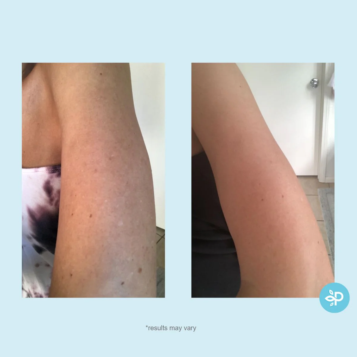 Hydro-Glo Peel Pads 40% - Image 4