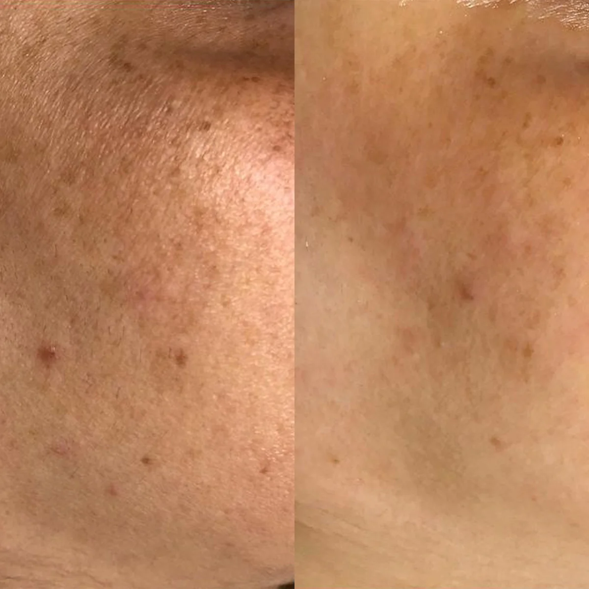 Hydro-Glo Peel Pads 40% - Image 5