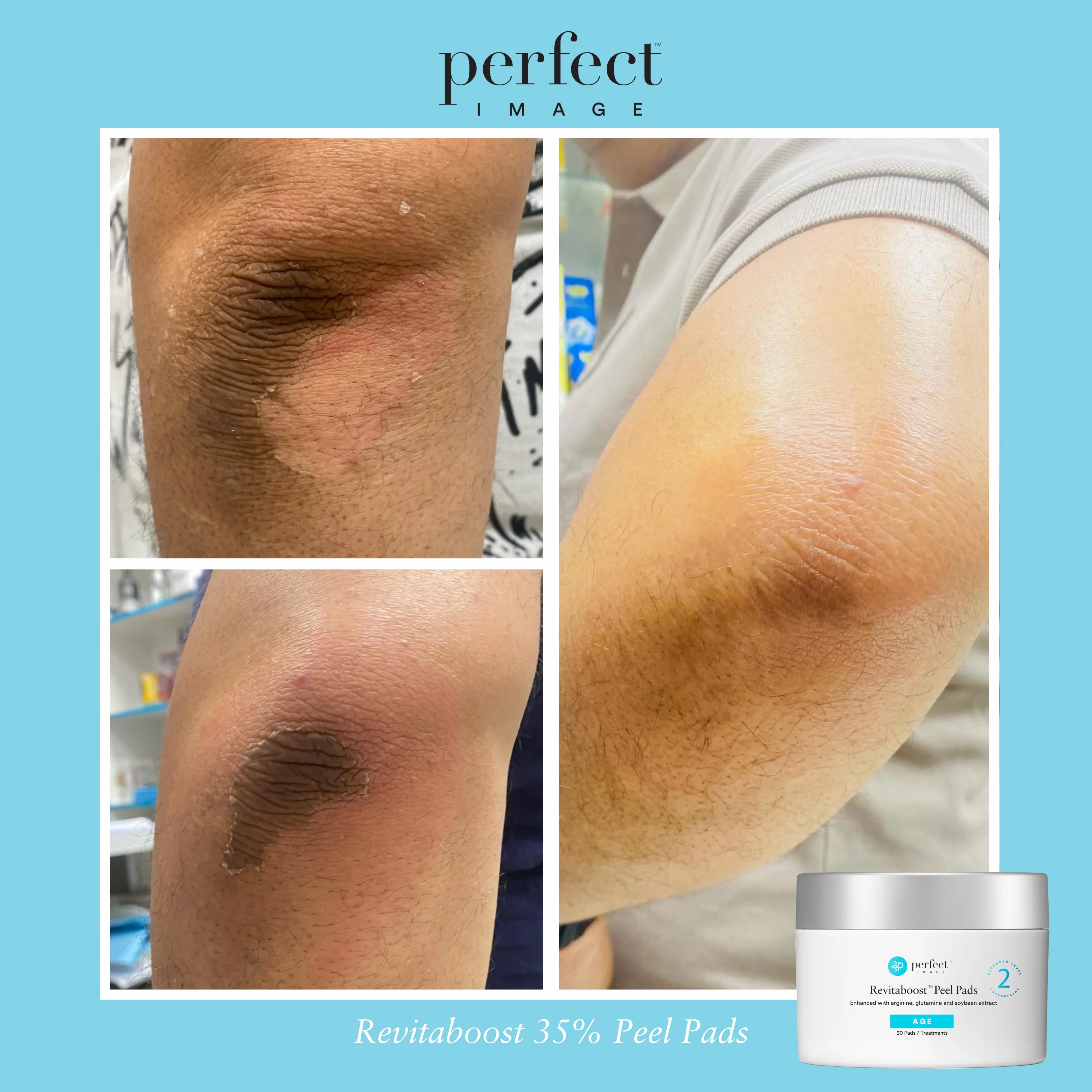 Revitaboost Peel Pads 35% - Image 8